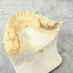 Impianti dentali